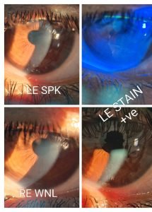 WhatsApp Image 2025-05-20 at 9.45.32 PM