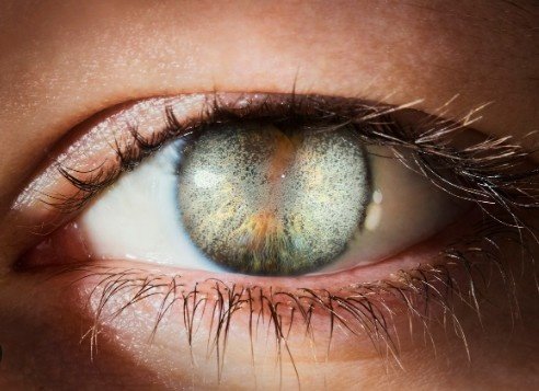 Best Treatment for Corneal Dystrophy in Sector 51, Gurugram