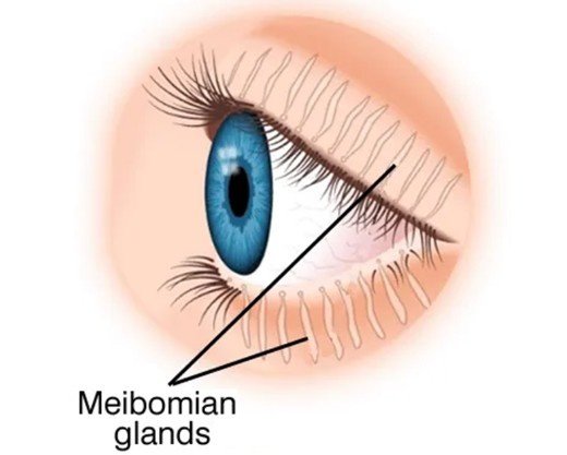 Best Meibomian Gland Dysfunction Treatment in Gurugram